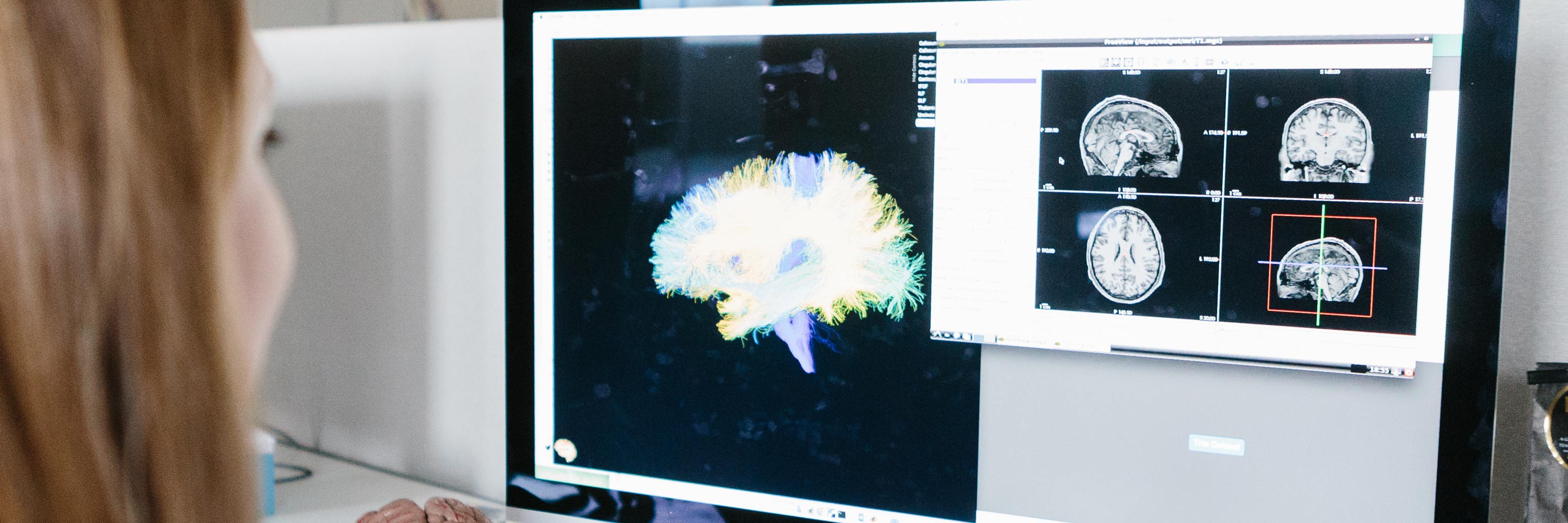 woman looking at brain scans on a computer